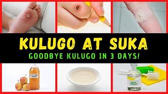 Image result for Kulugo