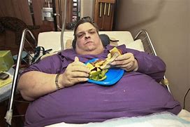 Image result for Super Morbidly Obese People