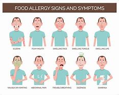 Image result for Food Allergy Rash On Face
