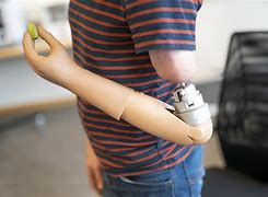 Image result for Prosthetic Arms and Hands