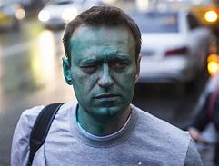 Image result for Blue Faced Navalny