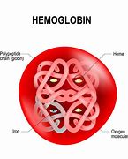 Image result for Hemoglobin E