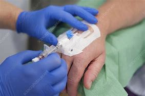 Image result for Cannula in Hand