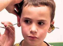 Image result for Pictures of Weird Ears