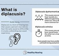 Image result for diplacusis