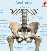 Image result for coxalgia