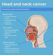 Image result for Anatomy of Head and Neck Cancer