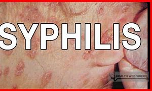 Image result for Syphilis Back