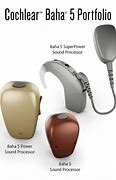 Image result for Baha Cochlear Parts
