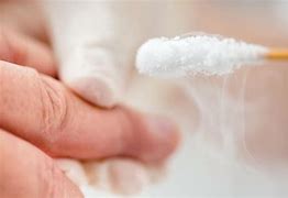 Image result for Wart After Salicylic Acid Treatment