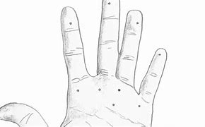 Image result for Warts On Your Hands
