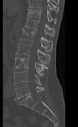 Image result for 4 Cm Lesion