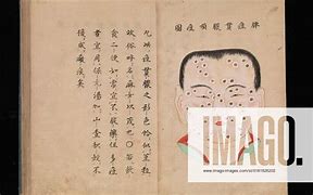 Image result for Japanese Small Pox Manuscript