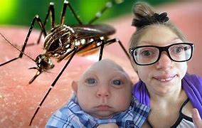 Image result for Zika Baaby