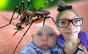 Image result for Zika Babies