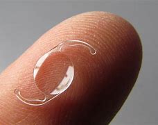 Image result for Posterior Chamber Intraocular Lens