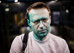 Image result for Alexei Navalny Dye