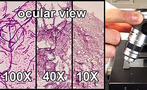 Image result for 100X Microscope View
