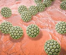 Image result for In Early Stages Genital Human Papillomavirus