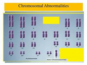 Image result for X Chromosome Disorders