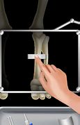 Image result for X-ray Games On the iPhone