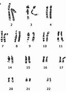 Image result for chromosom_homologiczny