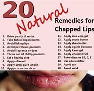Image result for Chapped Lips Cure
