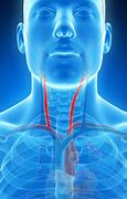 Image result for Carotid Sinus On a Person