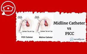 Image result for Accucath vs Midline