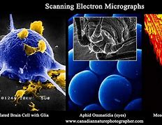 Image result for Scanning Electron Microscope Photography