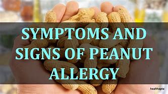 Image result for Peanut Allergy Reaction