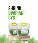 Image result for ovarian cyst treatment
