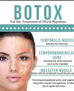 Image result for TMJ Botox