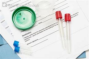 Image result for Difference Between Drug Screen and Test