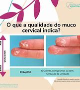 Image result for Muco Cervical