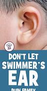 Image result for Swimmer's Ear in Kids