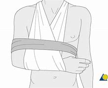 Image result for Picture of Arm Sling Clip Art as First Aid