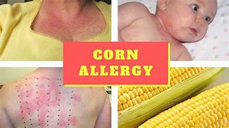 Image result for Corn Allergy Symptoms