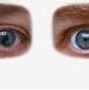 Image result for Disfigured Eye