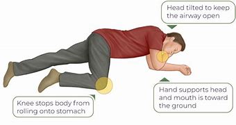 Image result for Recovery Position Diagram