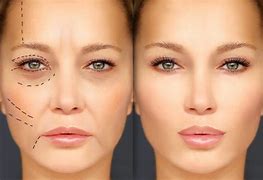 Image result for Pro Plastic Surgery