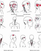 Image result for Four-Year Strong Brain Pain