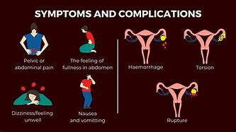 Image result for Ovarian Dermoid Cyst Symptoms