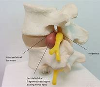 Image result for Cervical Foramen