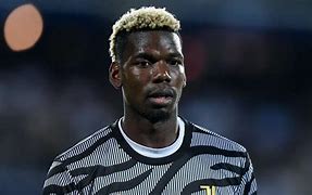Image result for Paul Pogba Injury