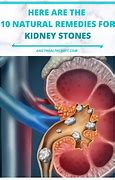 Image result for Passing Kidney Stones