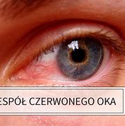 Image result for co_to_znaczy_zakon_smoka