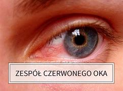 Image result for co_to_znaczy_Żywy_piasek