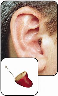 Image result for Rexton Hearing Aids