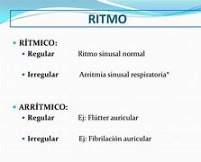 Image result for arr�tmico